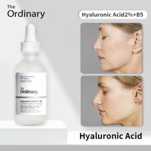 Ordinary Serum Result