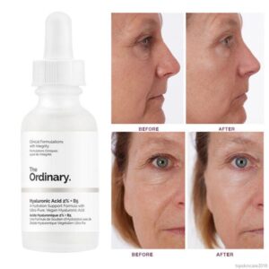 ordinary hyaluronic acid serum results