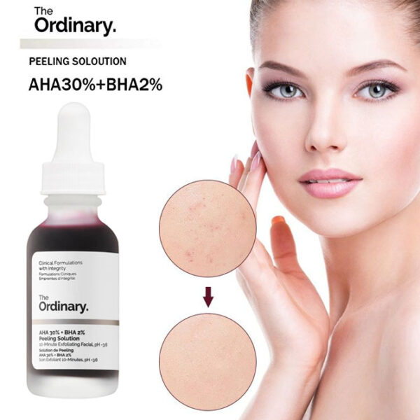 Ordinary-AHA-30-BHA-2-Peeling-Solution