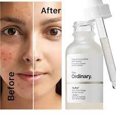 The Ordinary Buffet Reviews