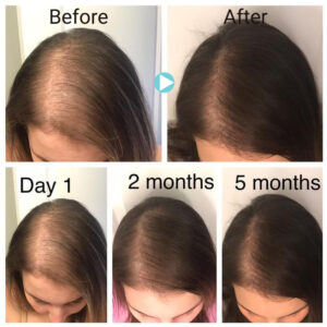 The Ordinary Multi-Peptide Serum For Hair Density Results